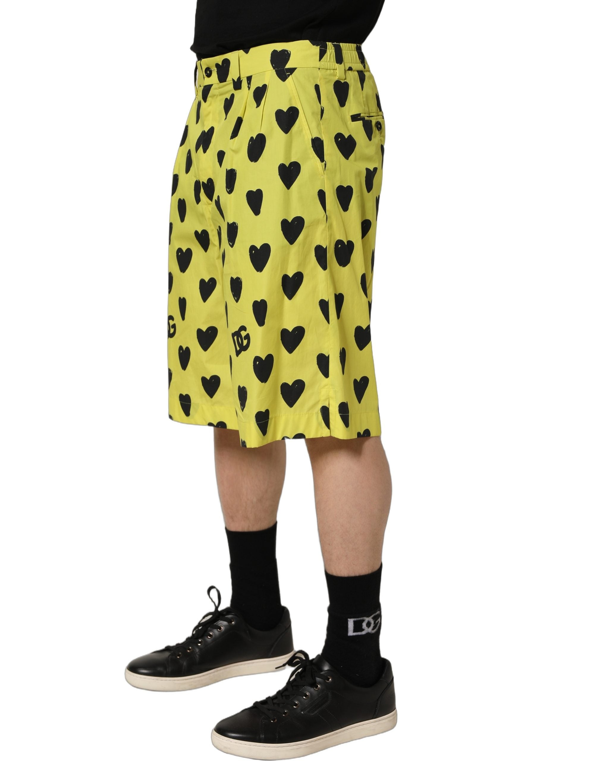 Dolce & Gabbana Yellow Cotton Heart Print Men Bermuda Shorts Dolce & Gabbana